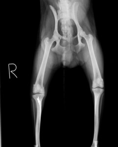 術後レントゲン