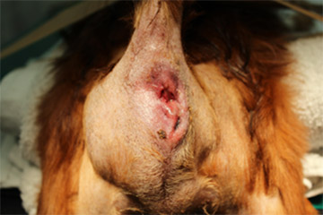 実際の手術症例