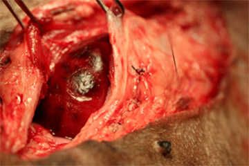 実際の手術症例
