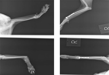 最新の骨折整復