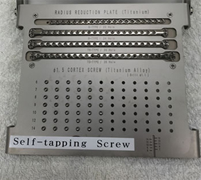 最新の骨折整復