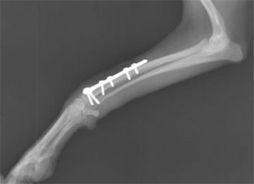 最新の骨折整復