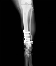 後肢脛腓骨骨折