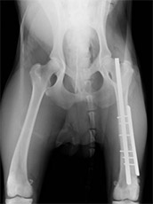 後足大腿骨骨折