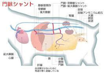 門脈体循環シャントとは