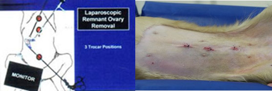 腹腔鏡下避妊手術