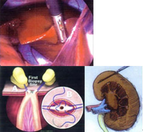 臓器の観察と生検