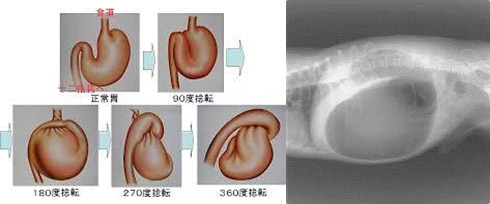 腹腔鏡下予防的胃固定手術