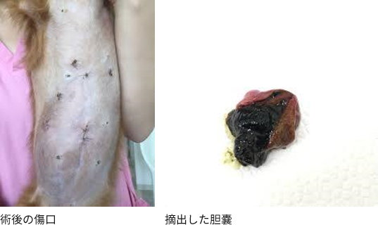 腹腔鏡下胆嚢摘出手術