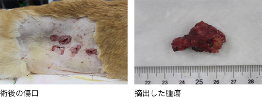 腹腔鏡下副腎腫瘍摘出手術