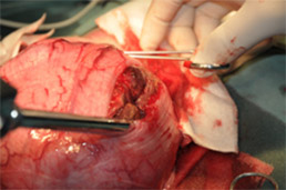 泌尿器系の悪性腫瘍